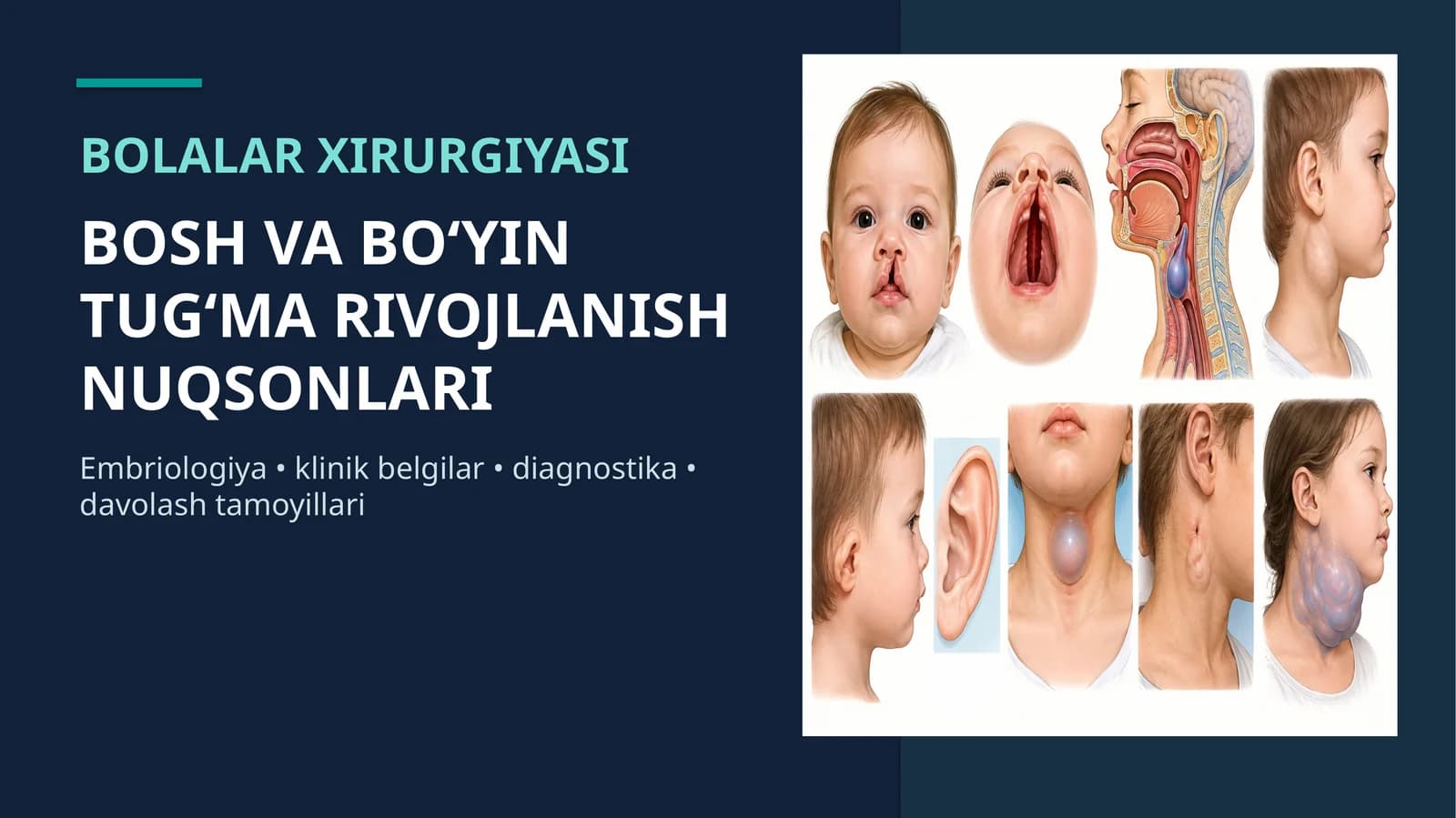Bolalarda bosh va bo`yin tug`ma nuqsonlari