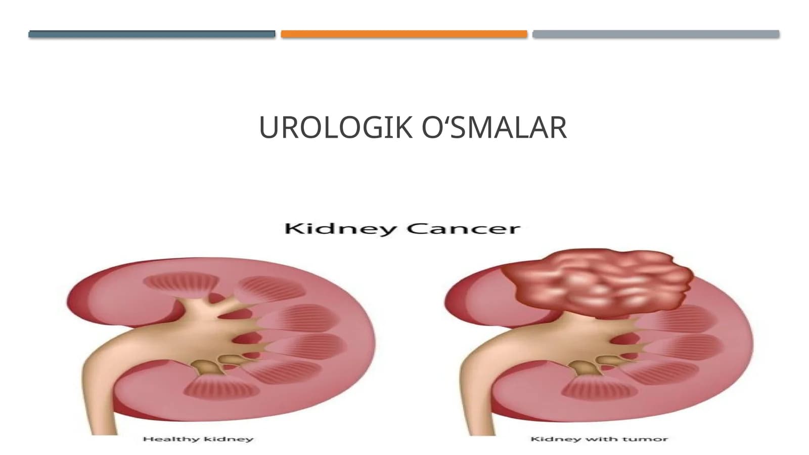 UROLOGIK O‘SMALAR
