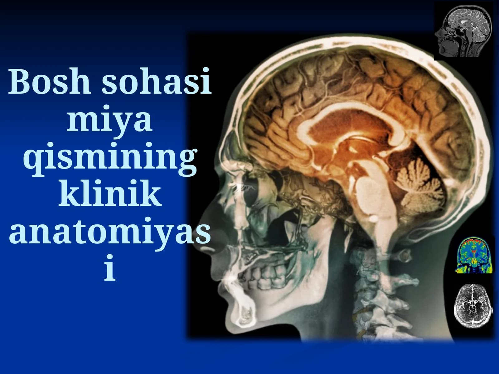 Bosh sohasi miya qismining klinik anatomiyasi