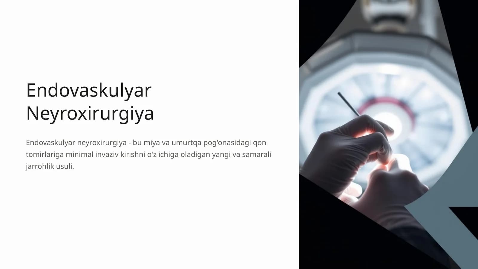 Endovaskulyar Neyroxirurgiya