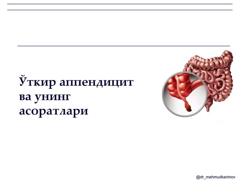 Ўткир аппендицит ва унинг асоратлари