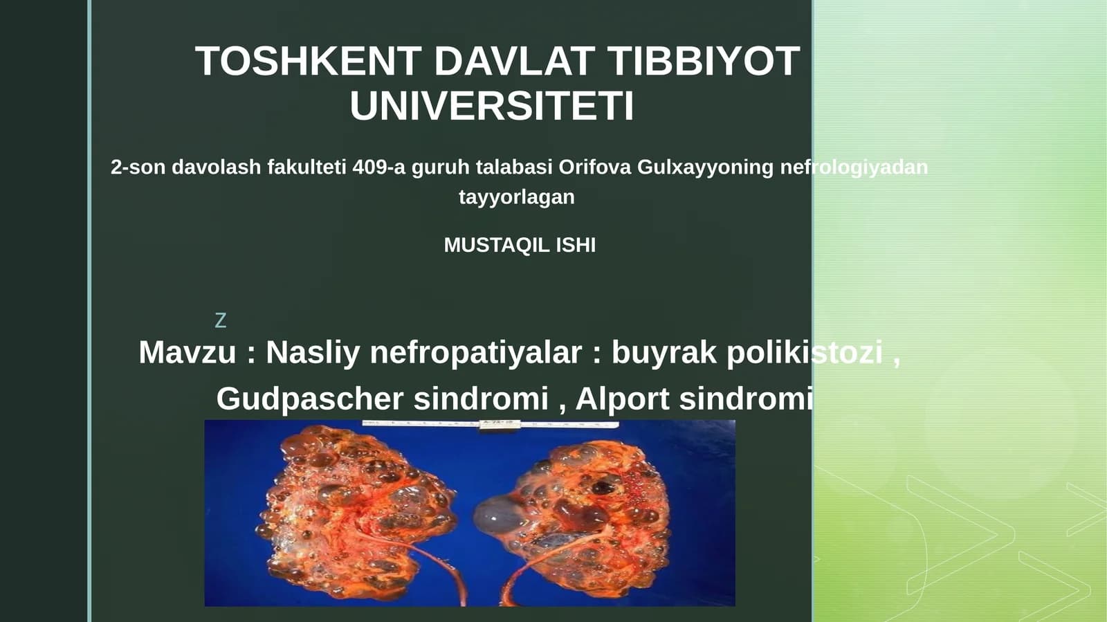 Nasliynefropatiyalar:buyrakpolikistozi,Gudpaschersindromi, Alportsindromi