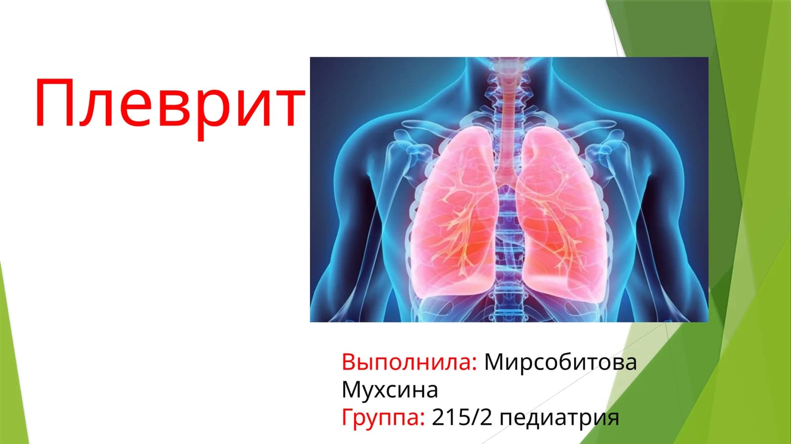Плеврит