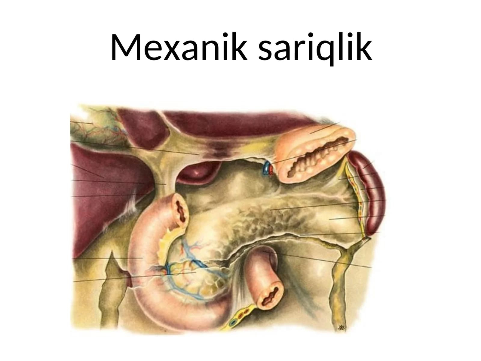 Mexanik sariqlik