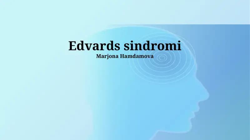 Edwards sindromi