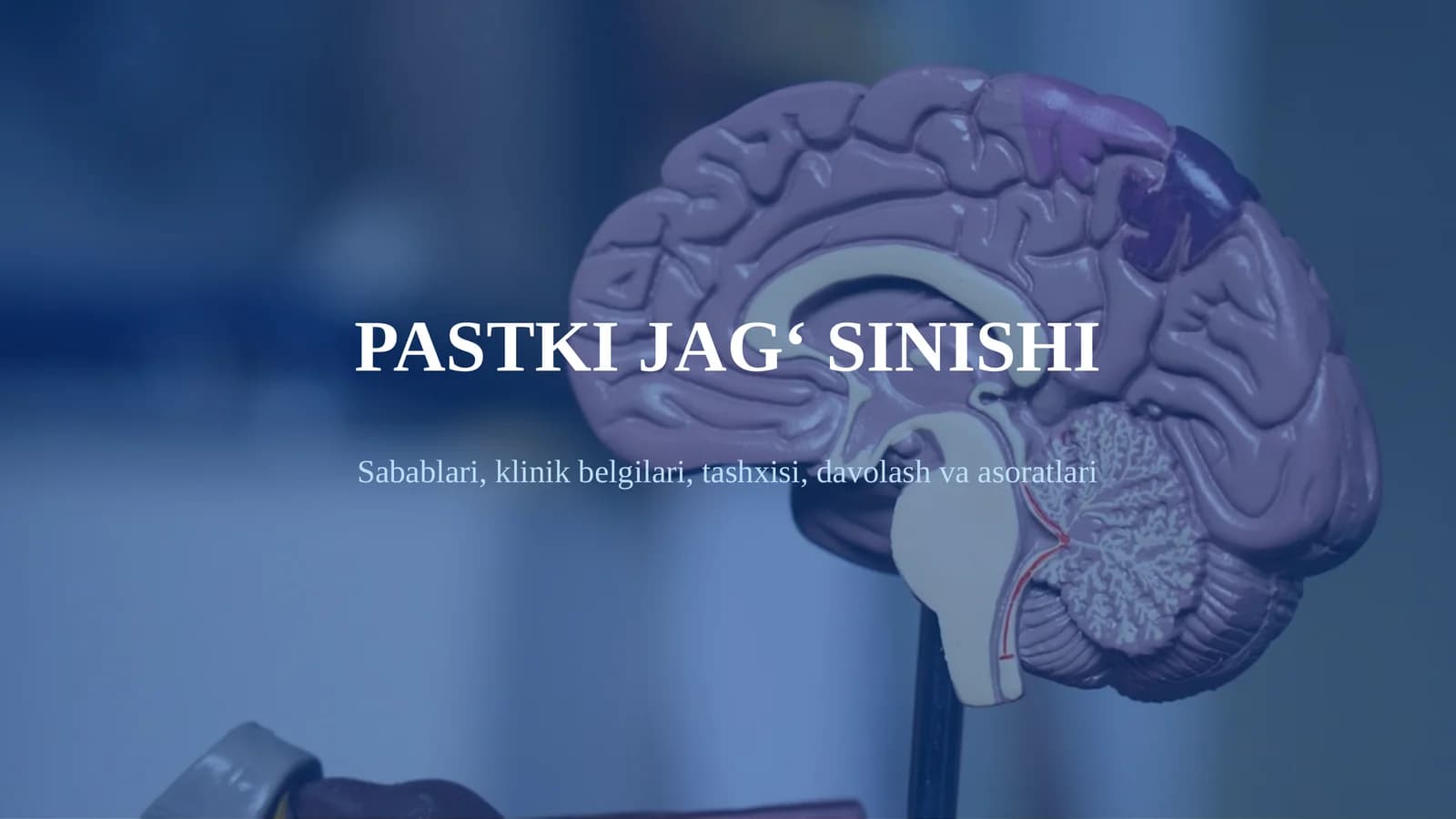 PASTKI JAG‘ SINISHI Sabablari, klinik belgilari, tashxisi, davolash va asoratlari. Pastki jag‘ sinishi haqida umumiy tushuncha