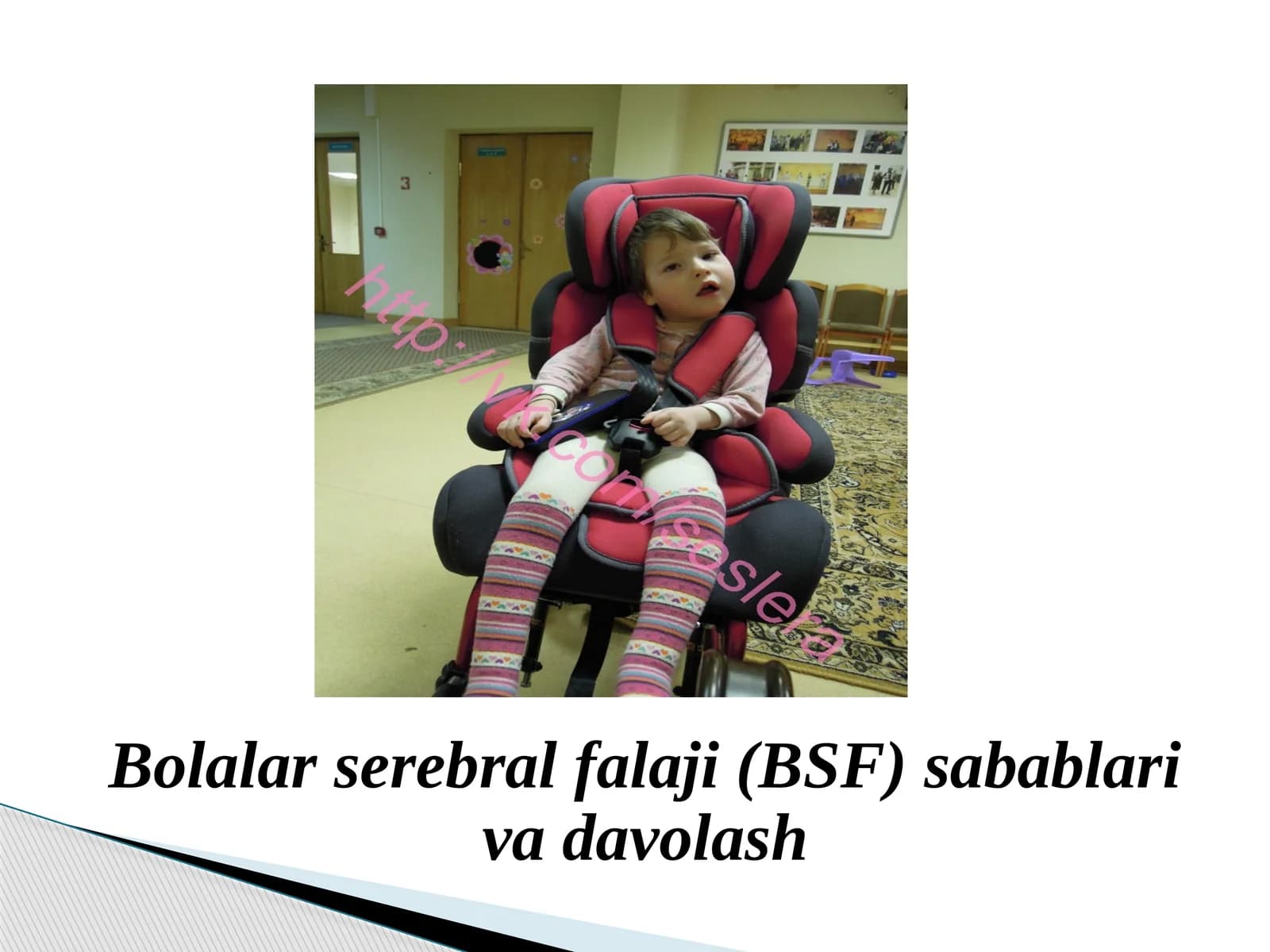Bolalar serebral falaji (BSF) sabablari va davolash