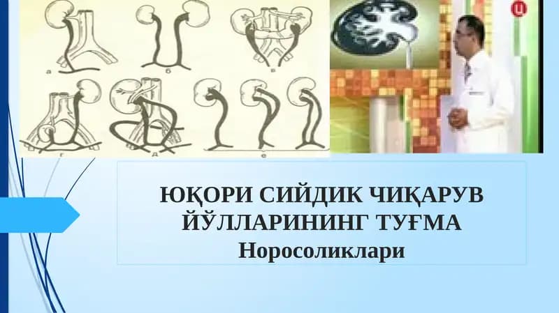 ЮҚОРИ СИЙДИК ЧИҚАРУВ ЙЎЛЛАРИНИНГ ТУҒМАНоросоликлари