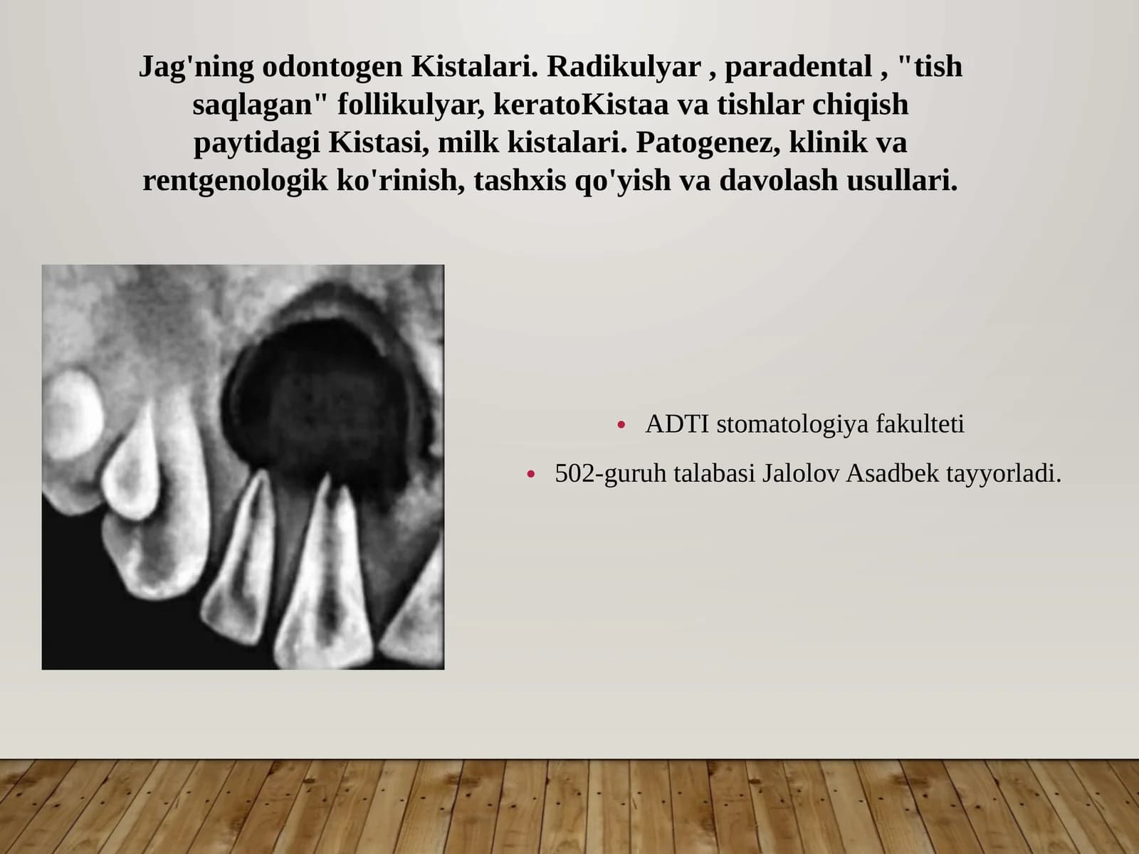 Jag'ning odontogenKistalari