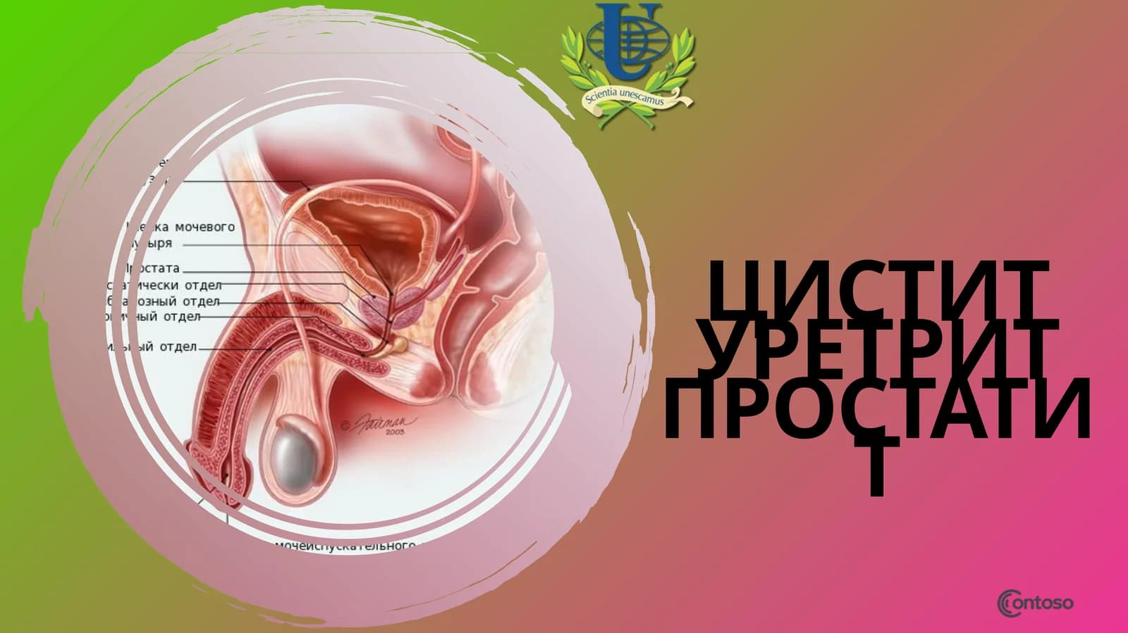 Цистит уретрит