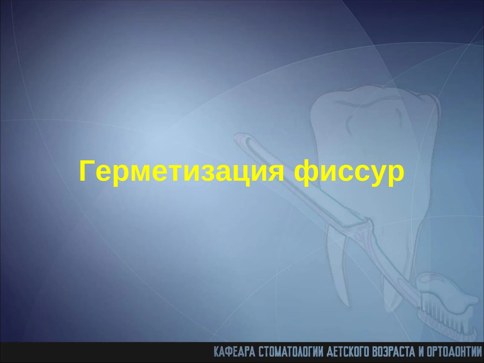 Герметизация фиссур