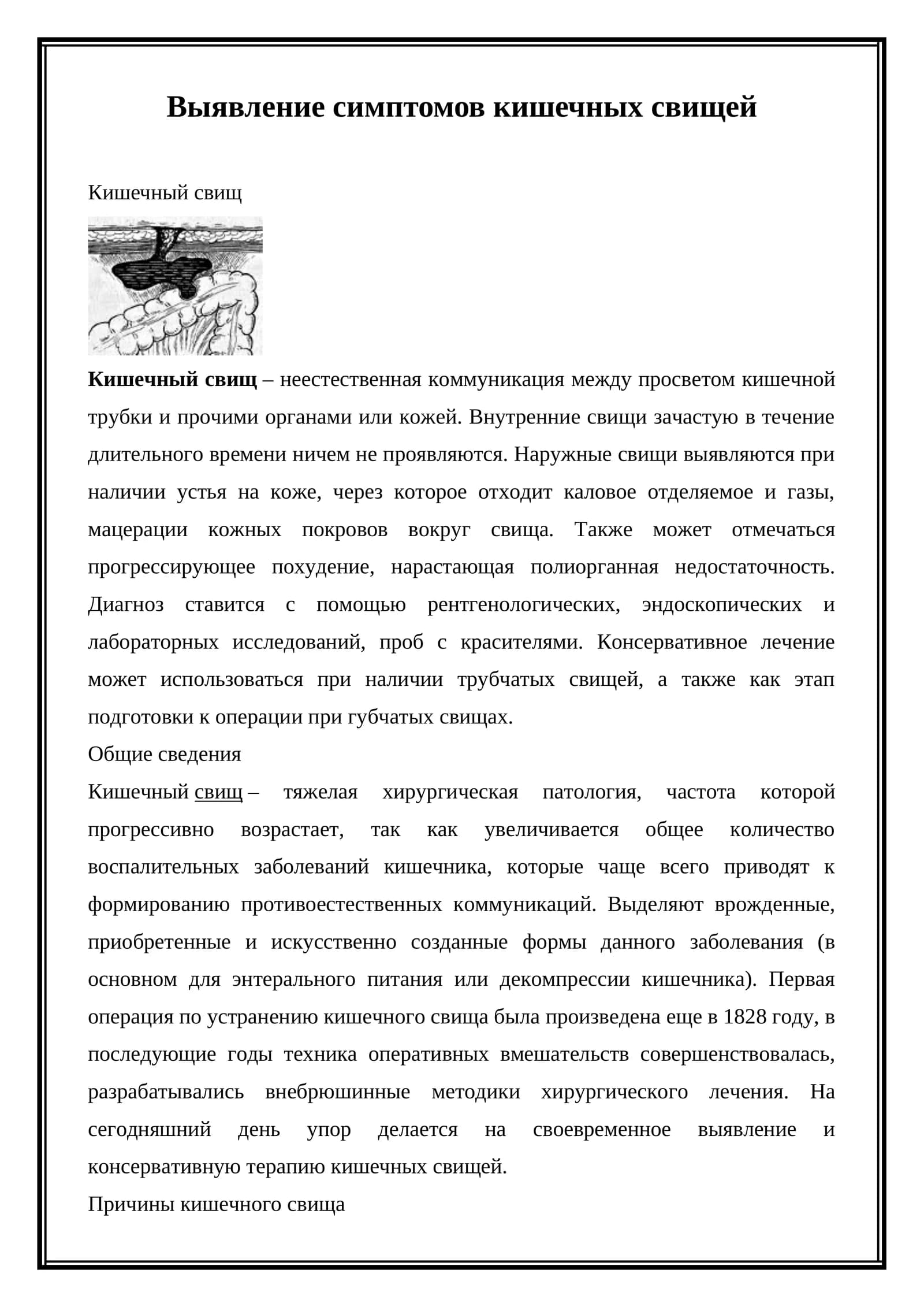 Кишечный свищ