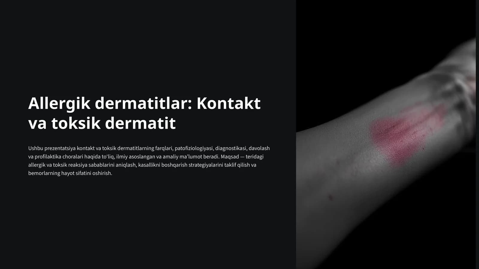 Allergik dermatitlar: Kontakt va toksik dermatit