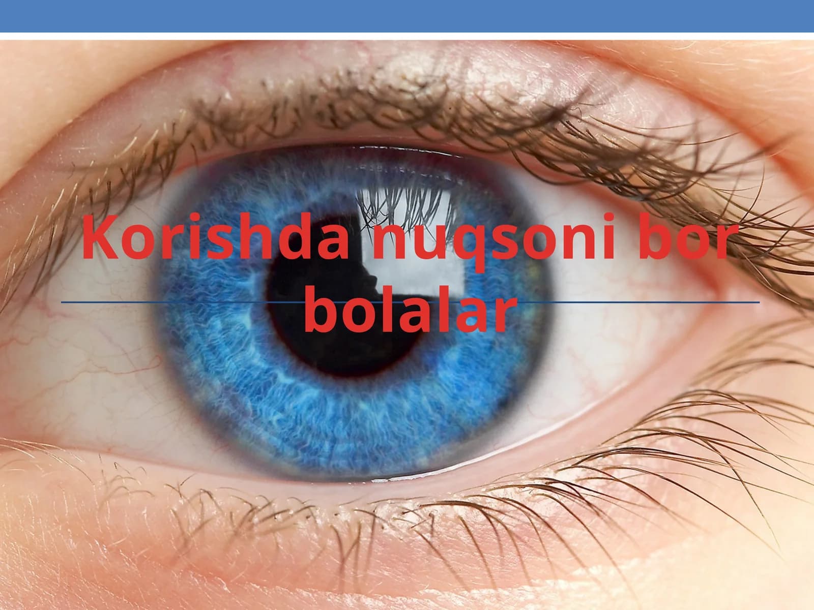 Korishda nuqsoni bor bolalar