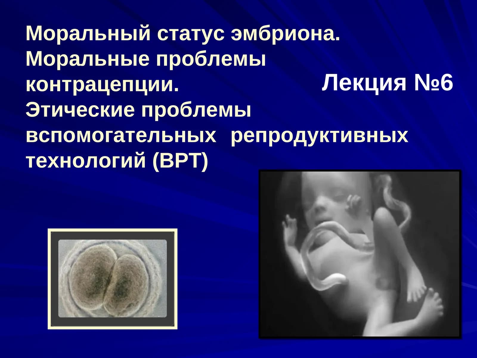 Моральный статус эмбриона