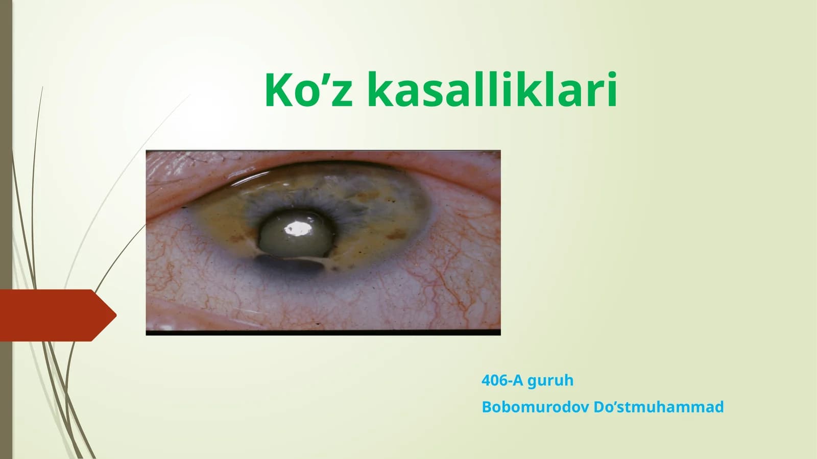 ko'z kasalliklari