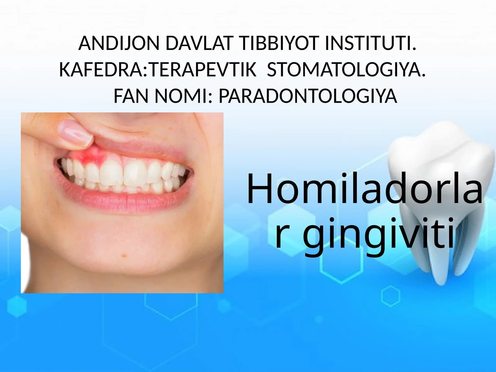 Homiladorlar gingiviti