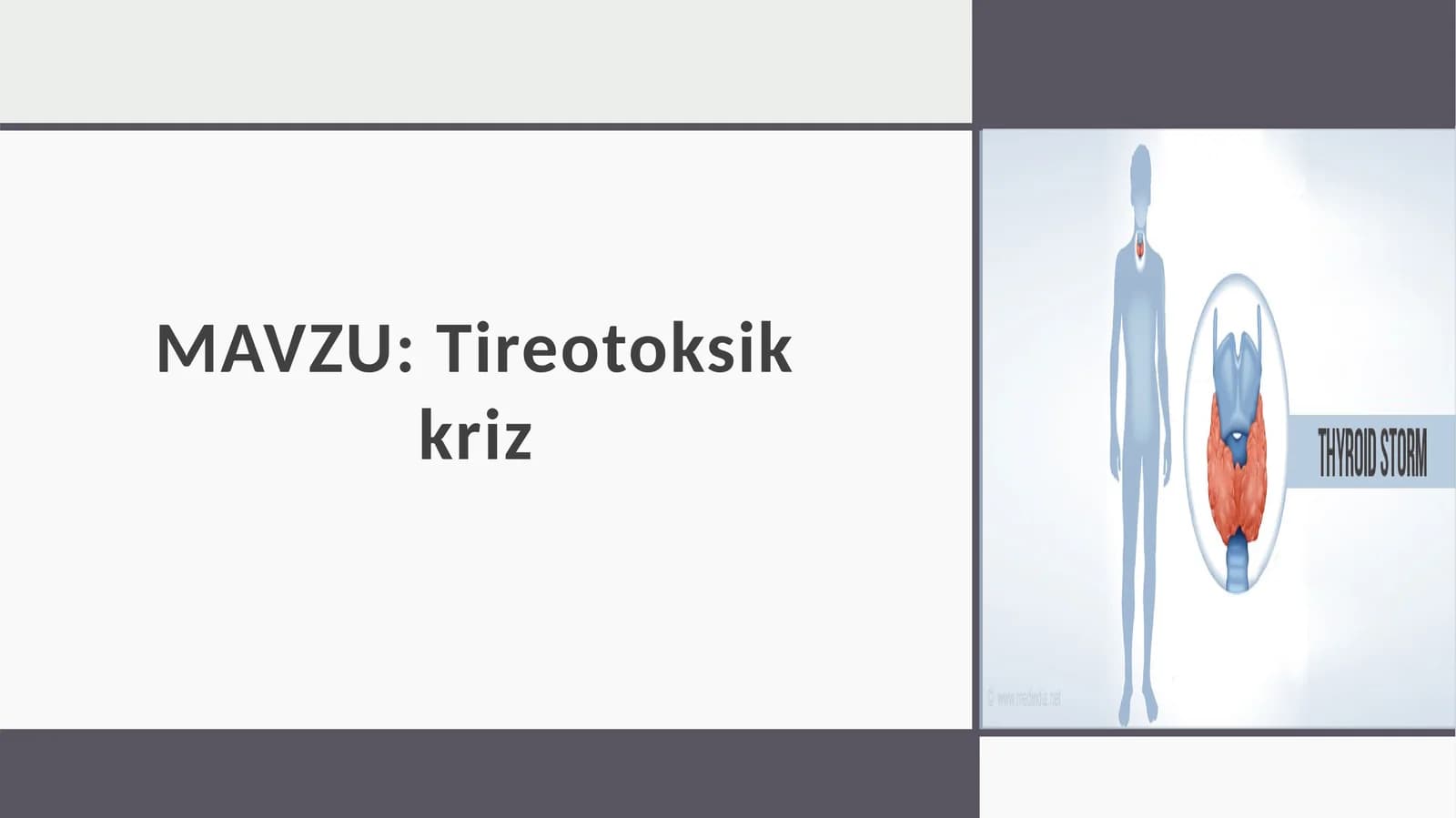 Tireotoksikkriz