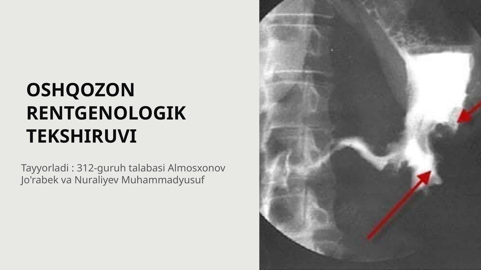 OSHQOZON RENTGENOLOGIK TEKSHIRUVI
