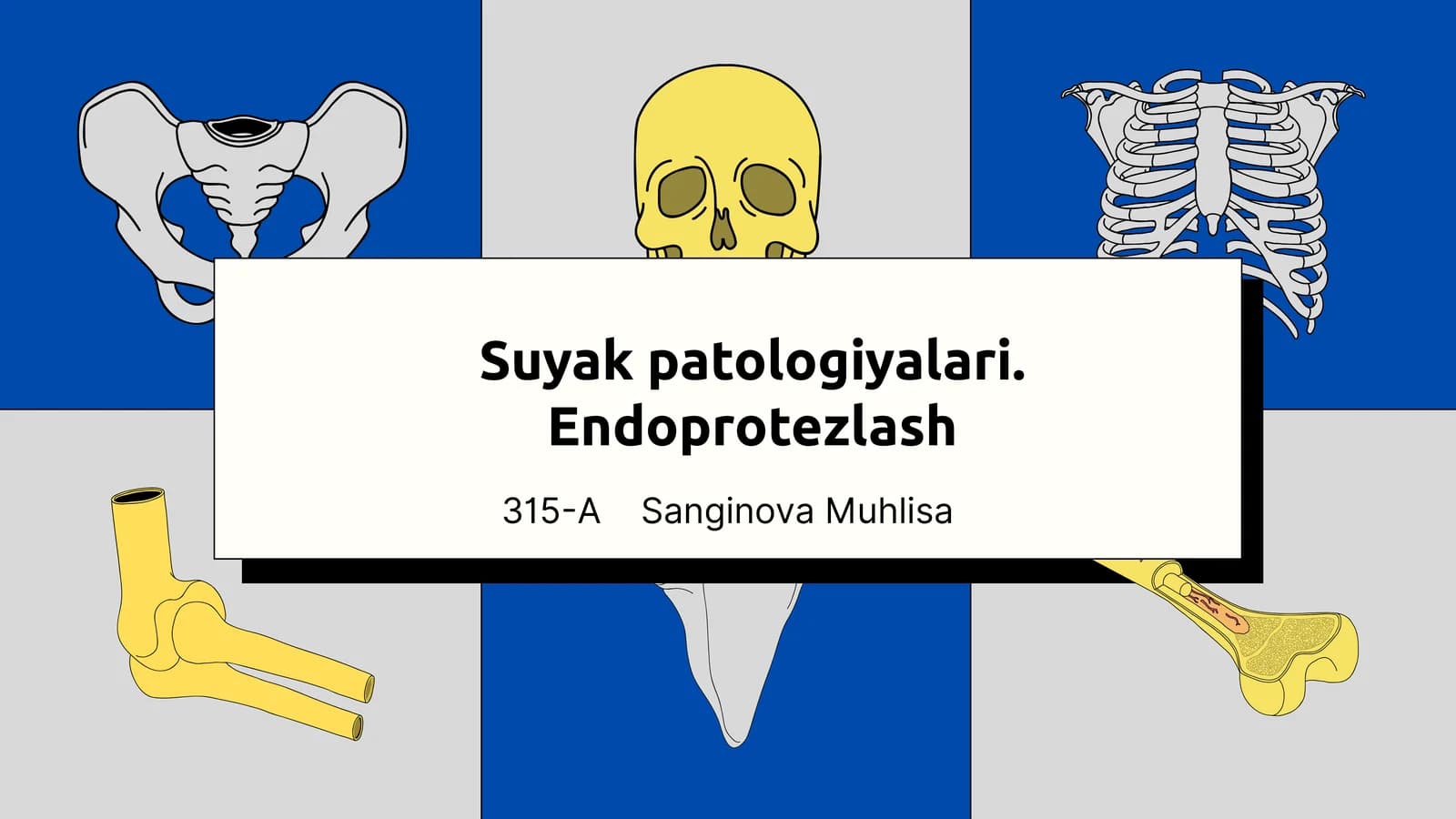Suyaklar patologiyalari. Endoprotezlash. Osteoparoz. Osteoartrit