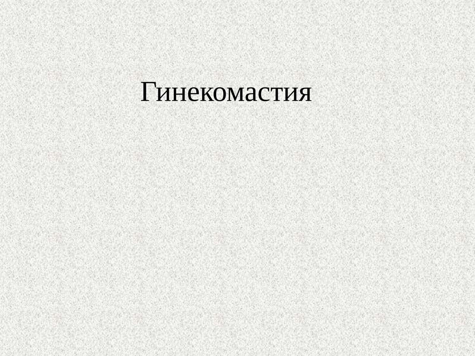 Гинекомастия