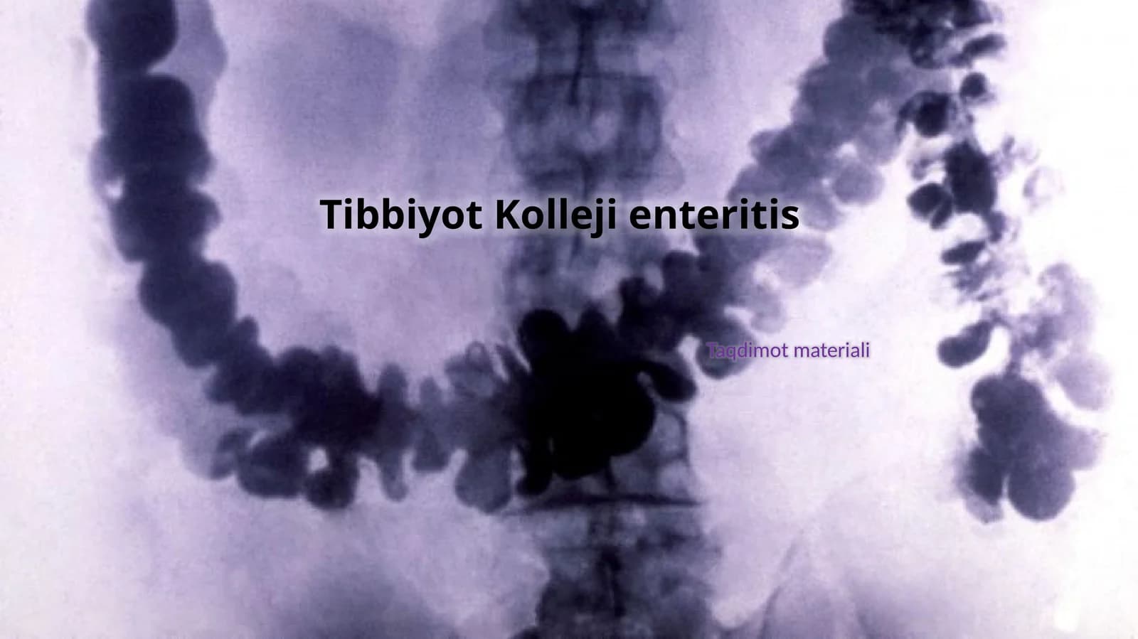 Enterit ingichka ichak yallig'lanishi (1-variant)
