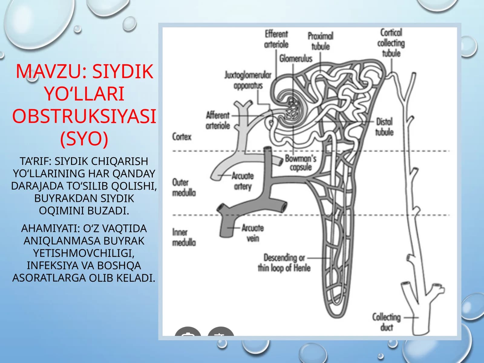 Siydik yo‘llari obstruksiyasi (SYO)