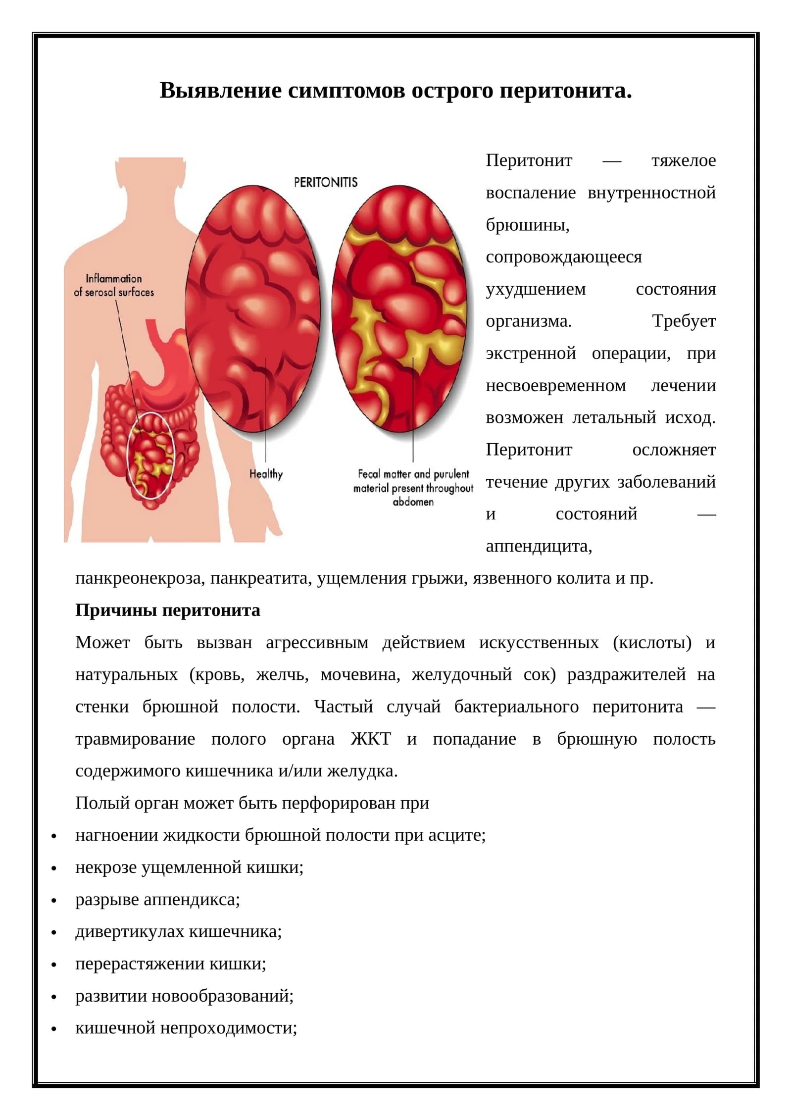 Выявление симптомов острого перитонита