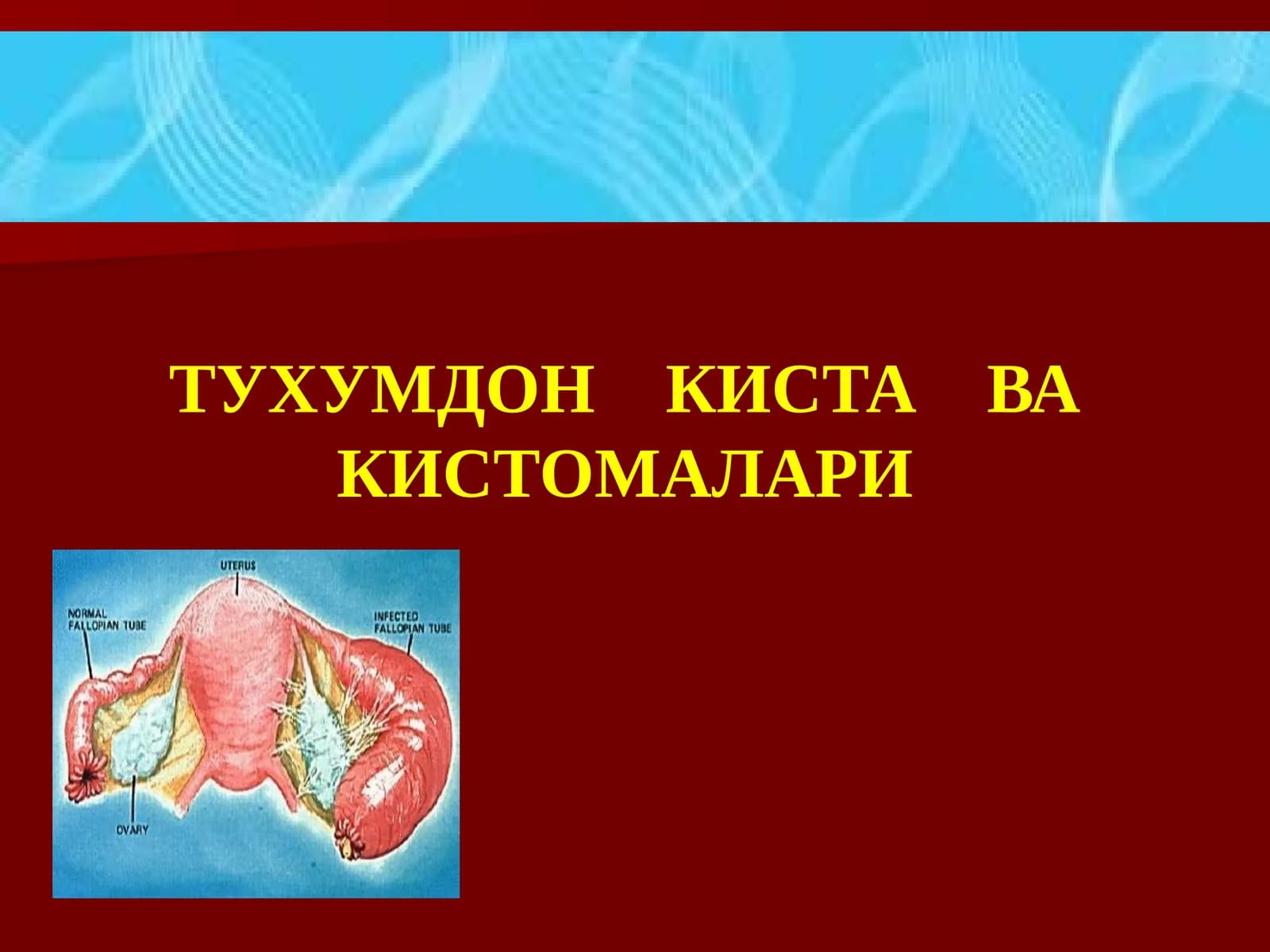 ТУХУМДОН КИСТА ВА КИСТОМАЛАРИ