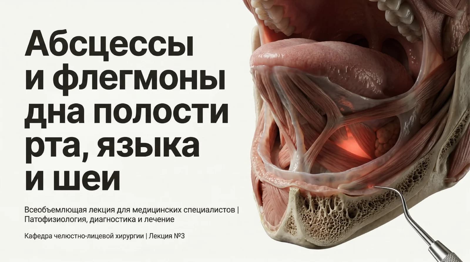 Абсцессы и флегмоны дна нолости рта языка и шеи