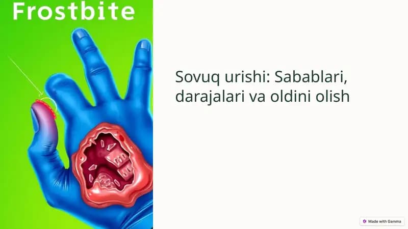 Sovuq urishi