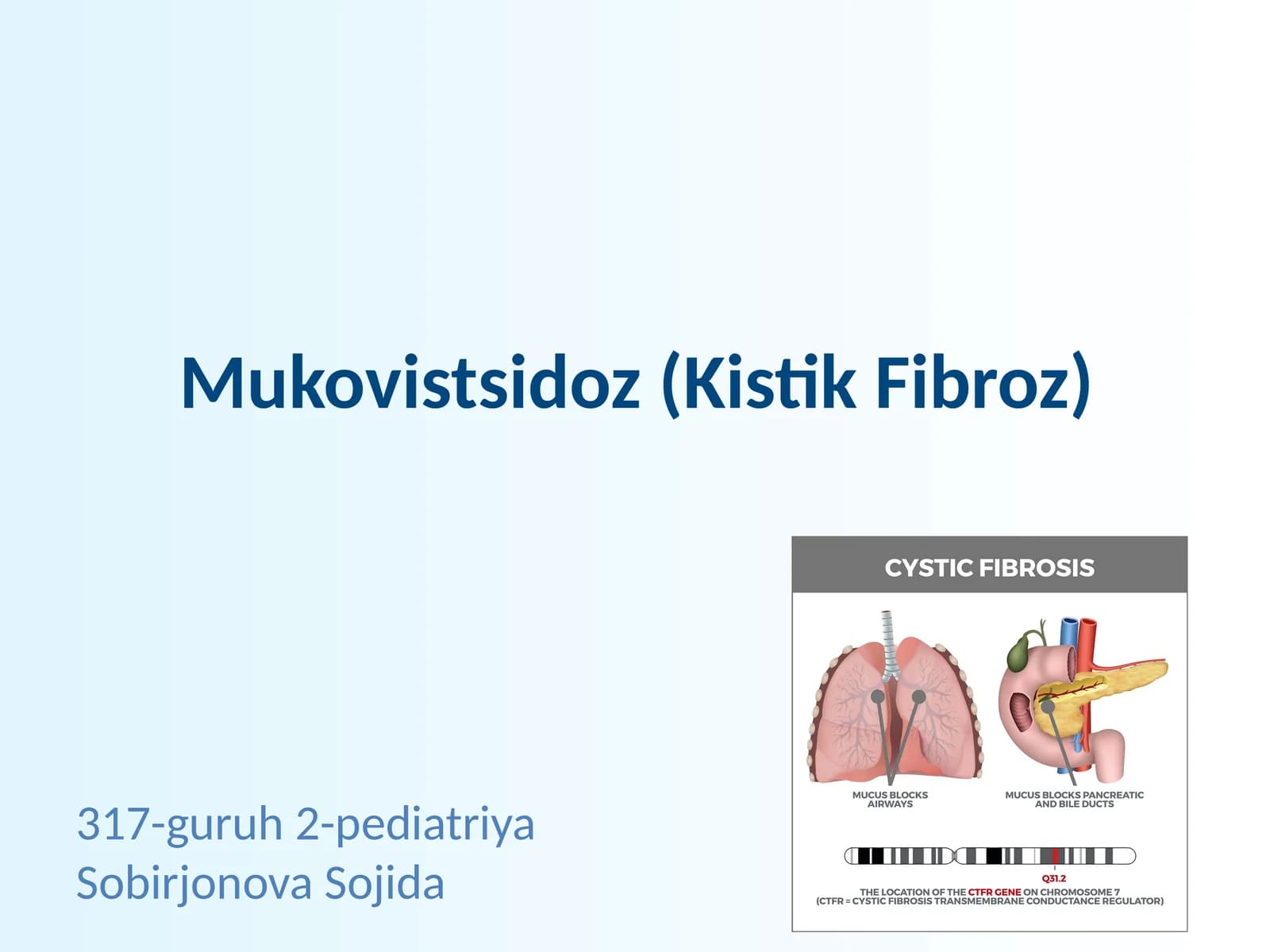 Mukovistsidoz (Kistik Fibroz)