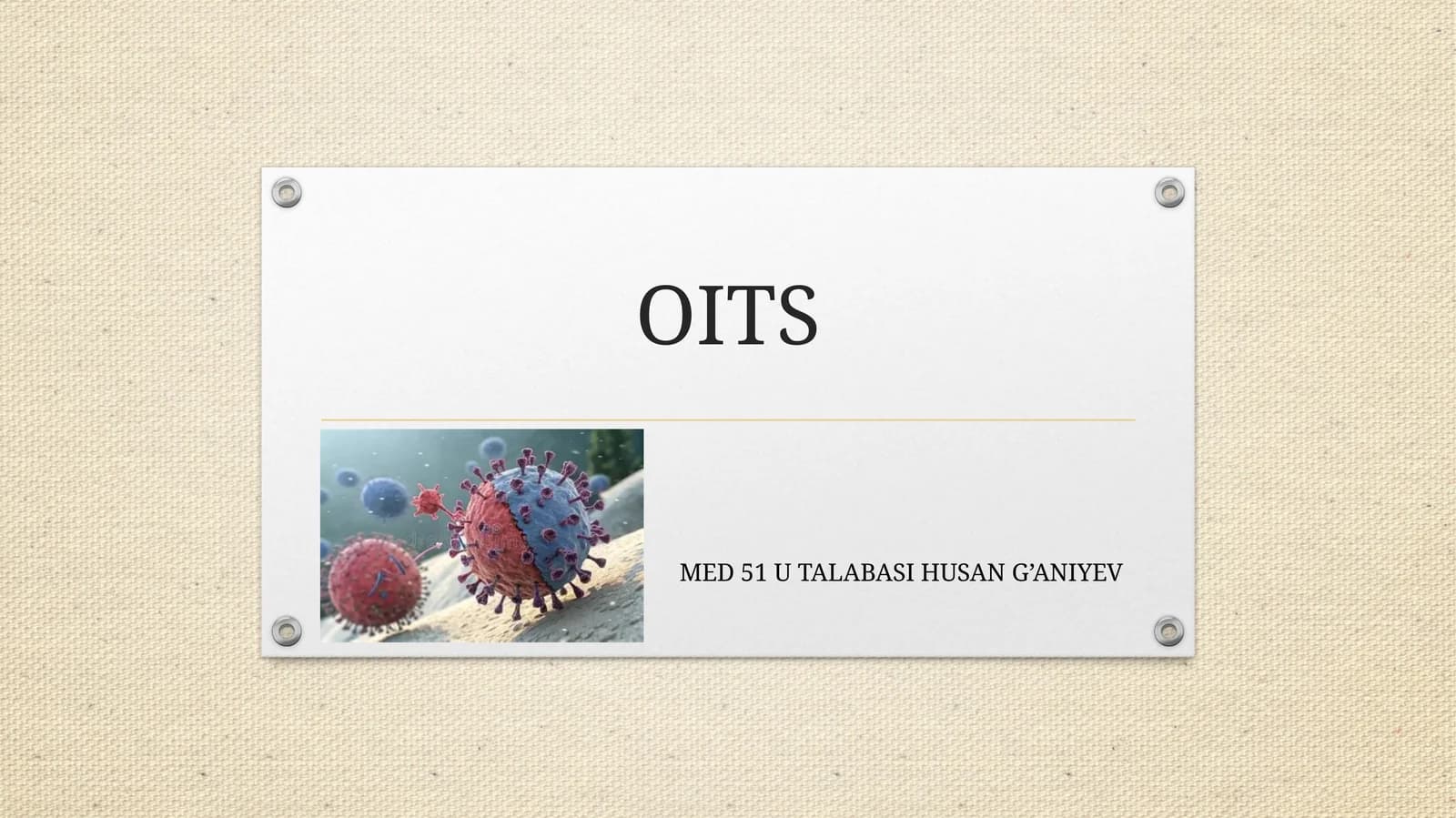 OITS