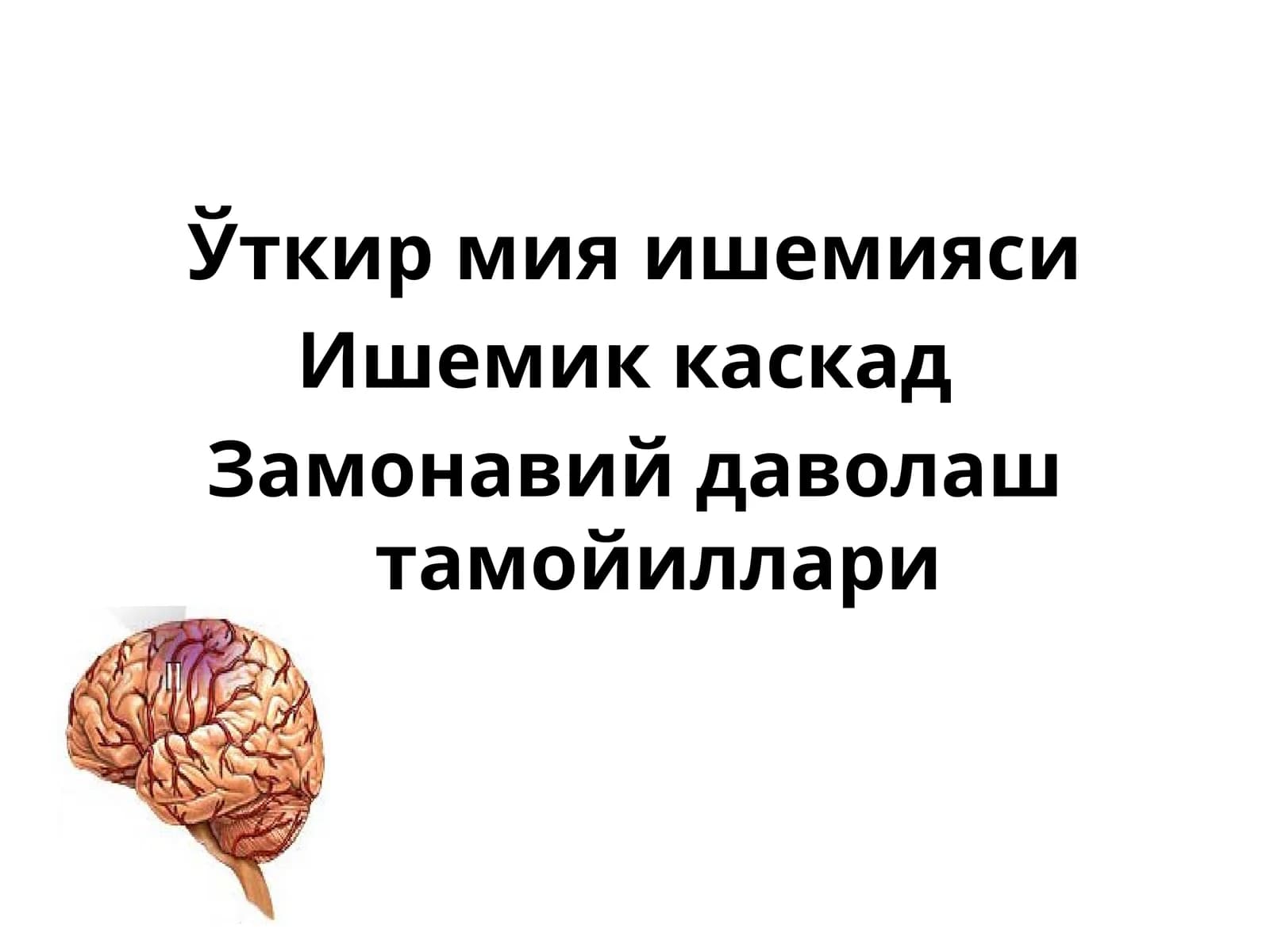 Ўткир мия ишемияси