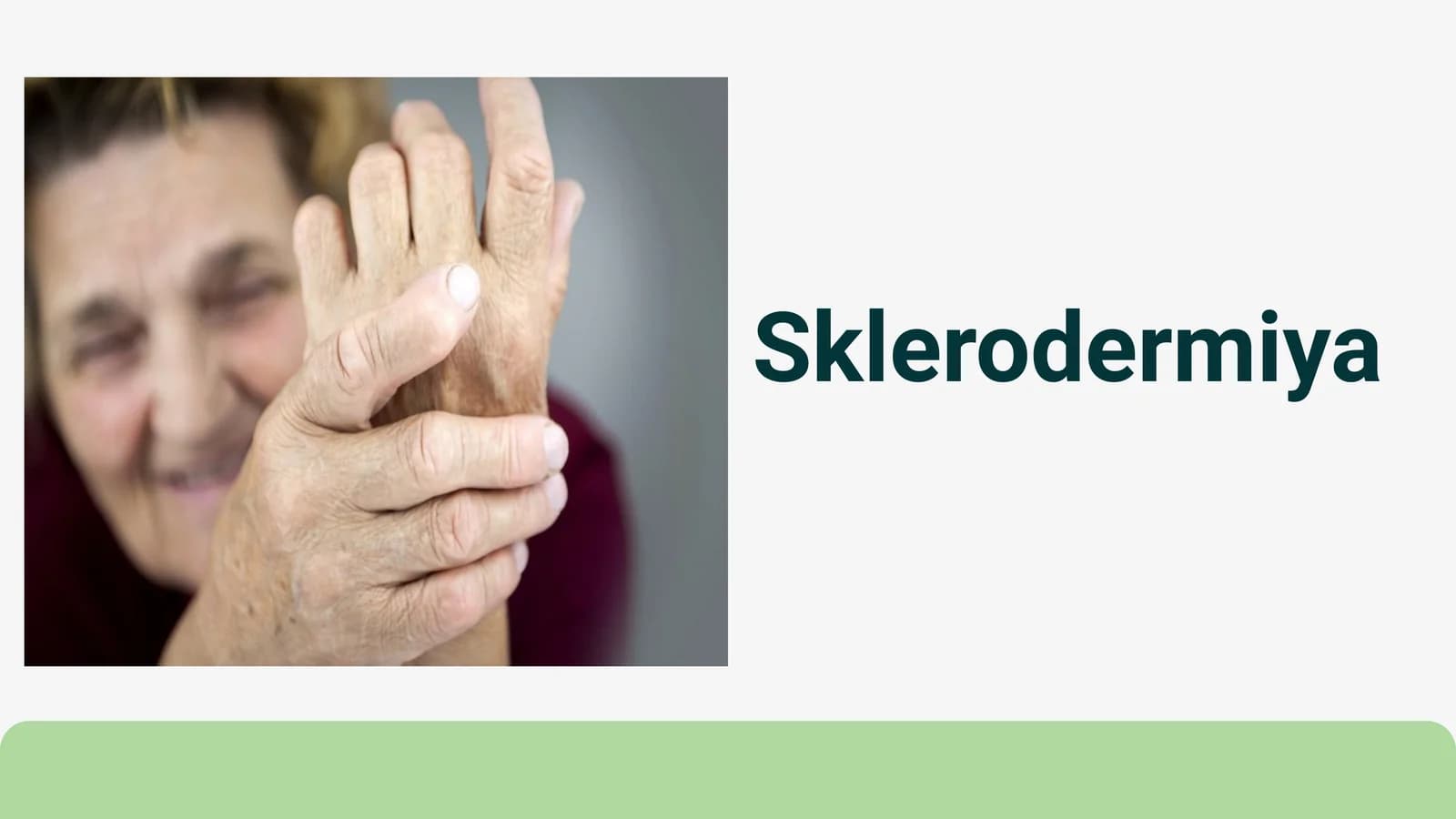 Sklerodermiya