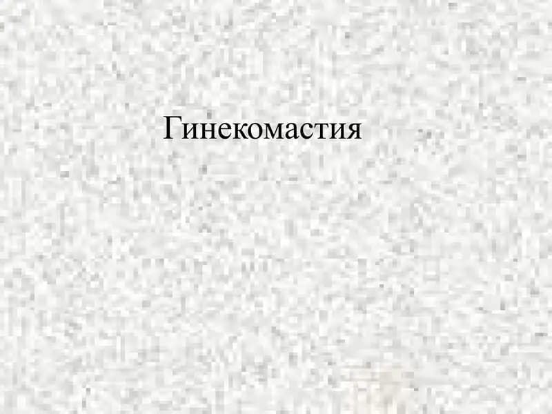 Гинекомастия
