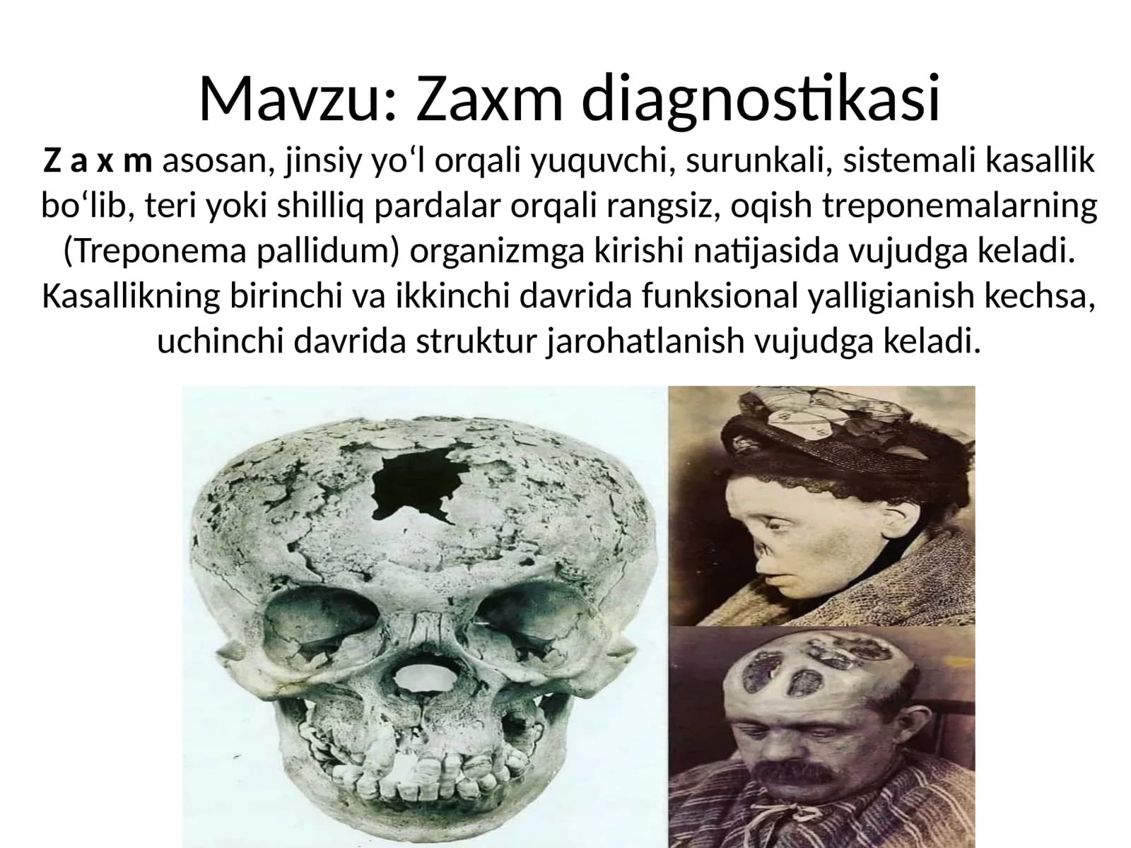 Zaxm diagnostikasi