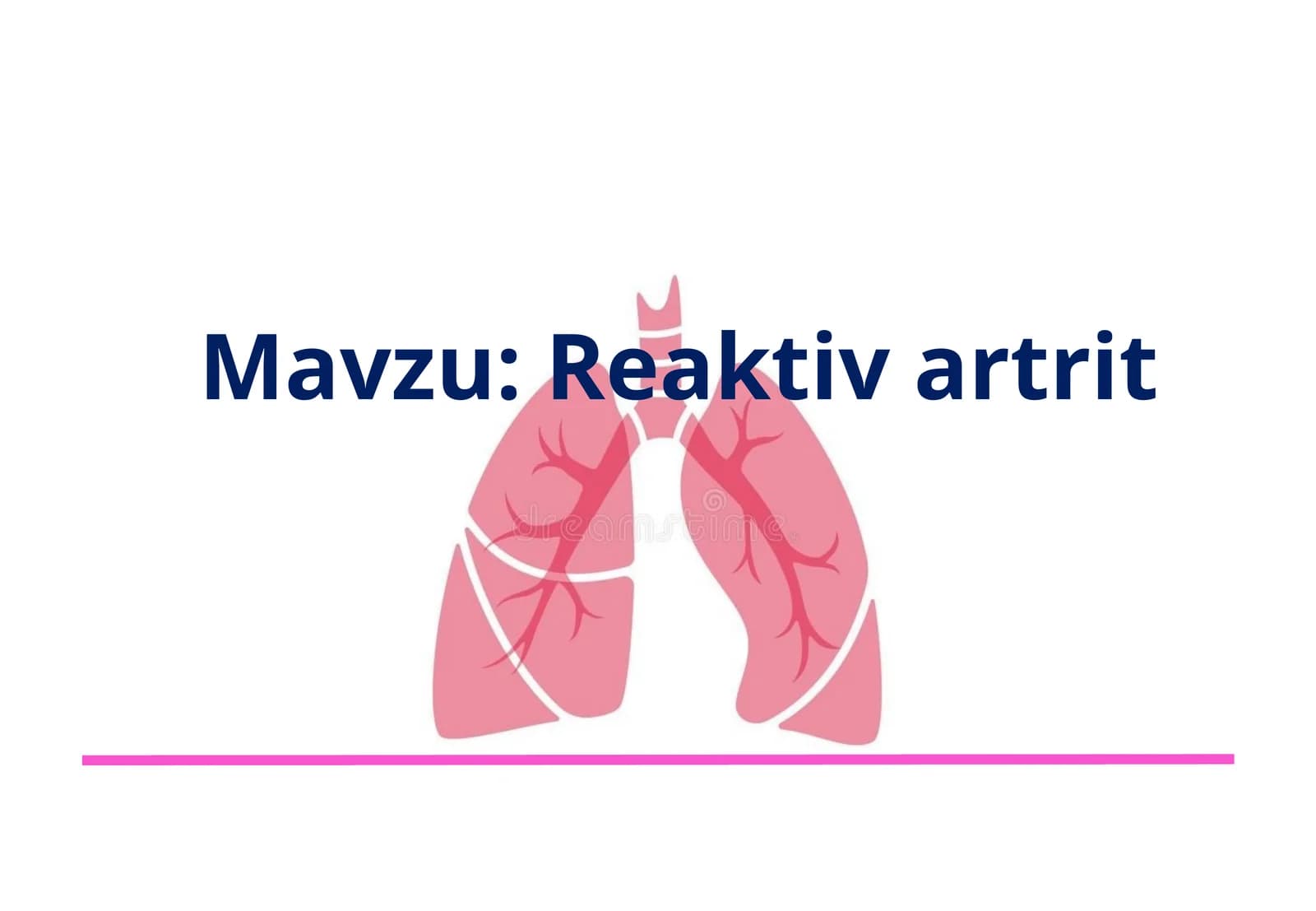 Reaktiv artrit