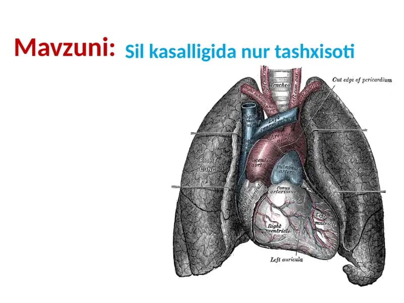 Sil kasalligida nur tashxisoti