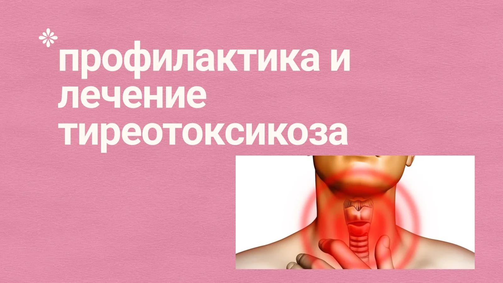 Профилактика и лечение тиреотоксикоза
