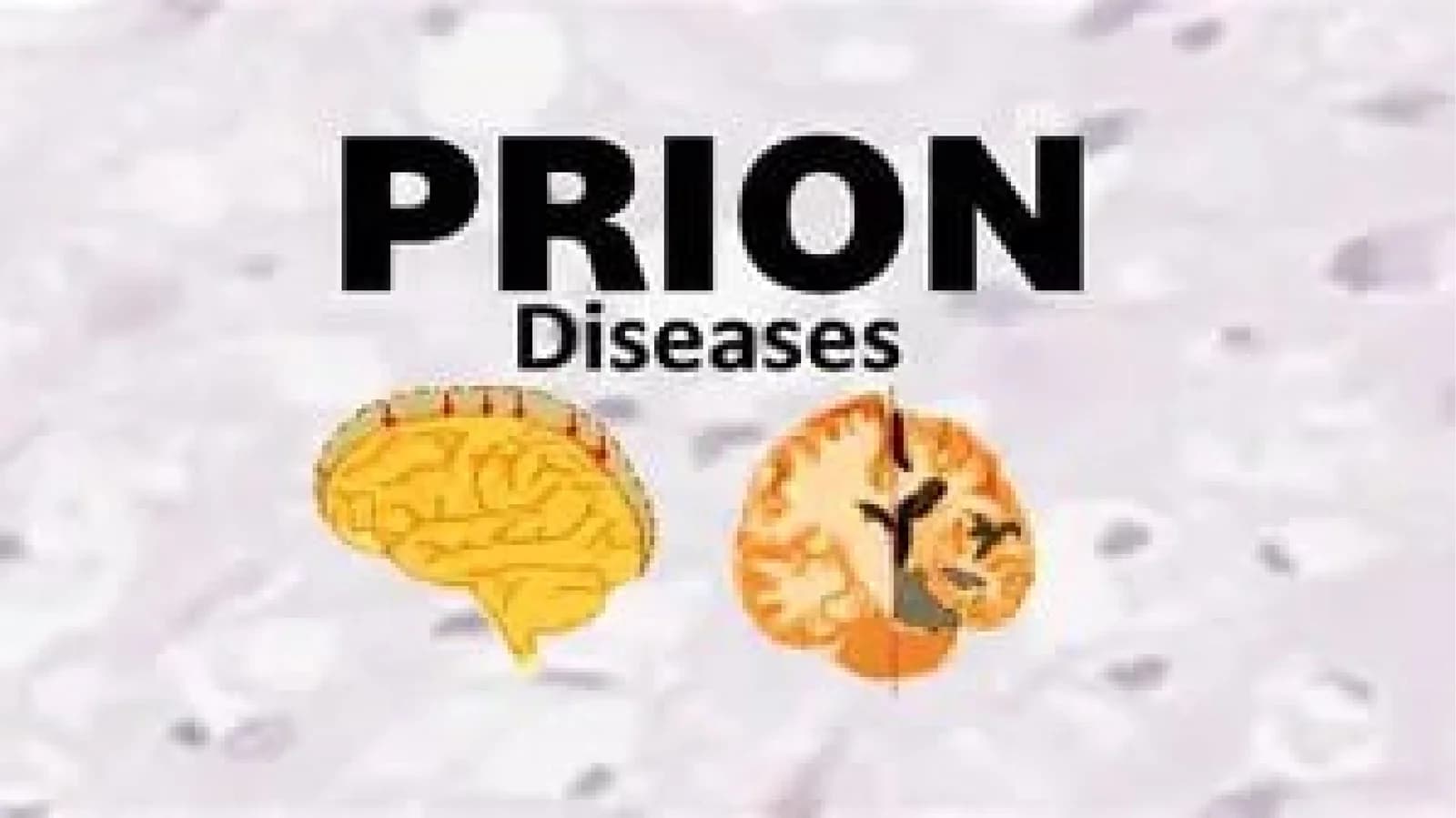 Prion Kasalliklari