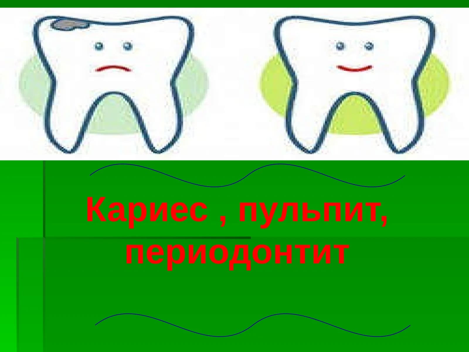 Karies rivojlanish etaplari