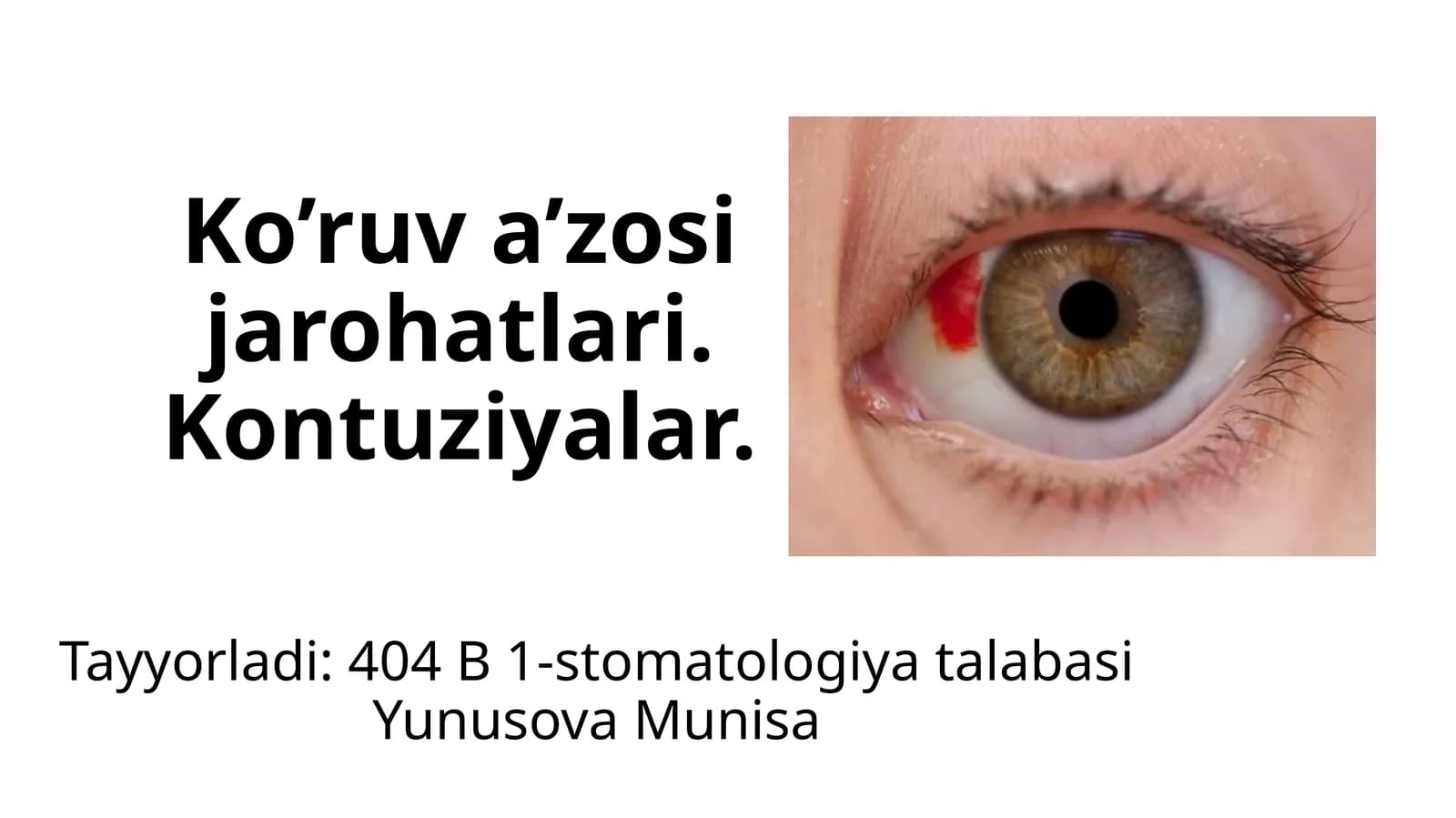 Ko’ruva’zosijarohatlari.Kontuziyalar