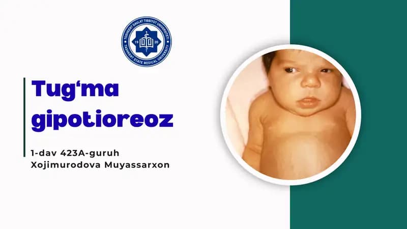 Tug‘ma gipotioreoz