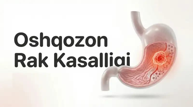 Oshqozon rak kasalligi