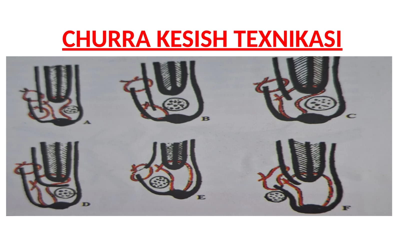 CHURRA KESISH TEXNIKASI