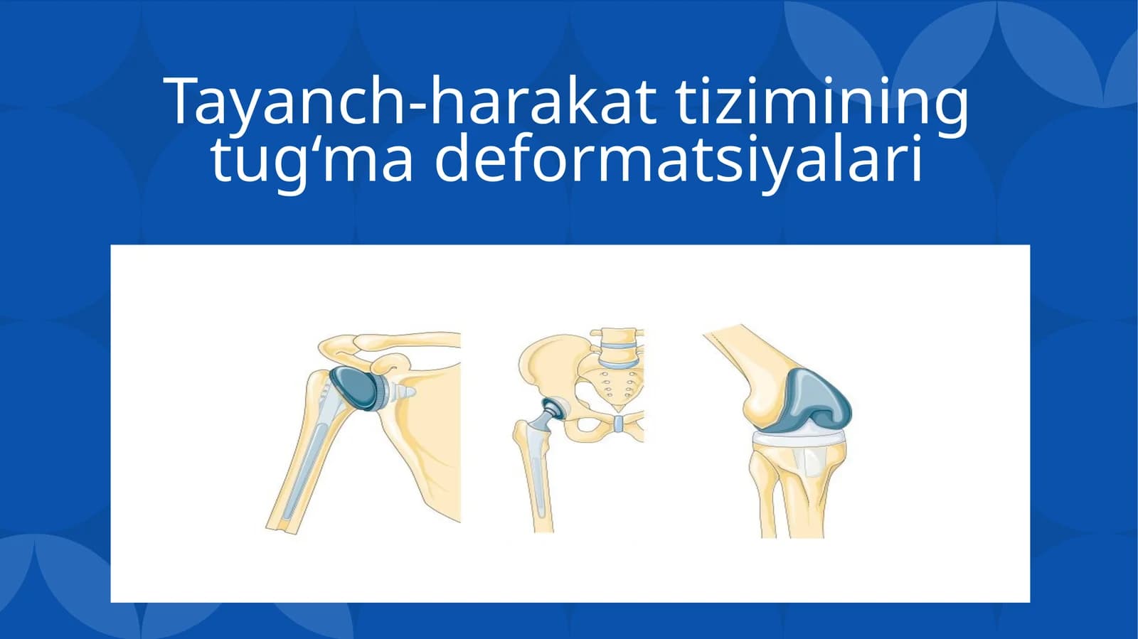 Tayanch-harakat tizimining tug‘ma deformatsiyalari