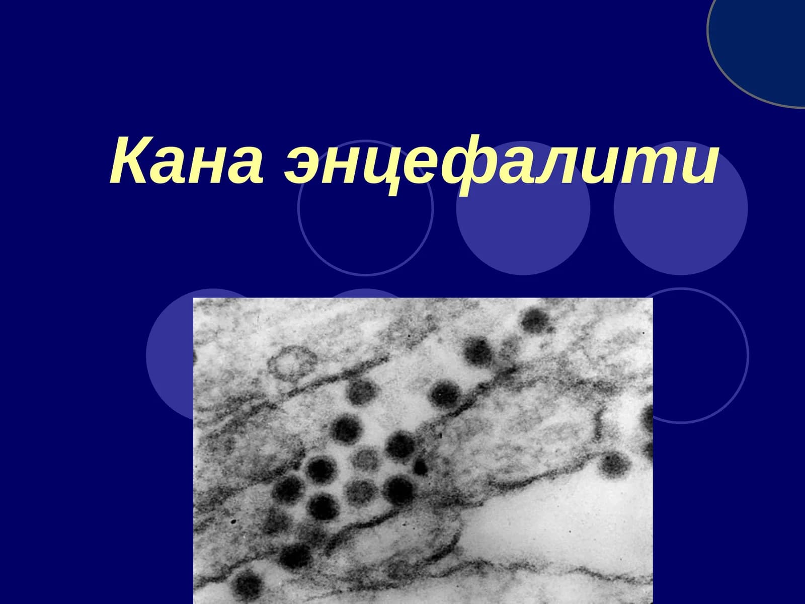 Кана энцефалити