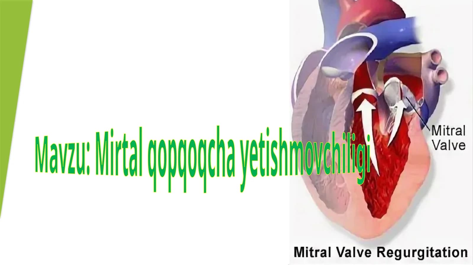 Mirtal qopqoqcha yetishmovchiligi