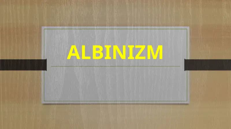 Albinizm
